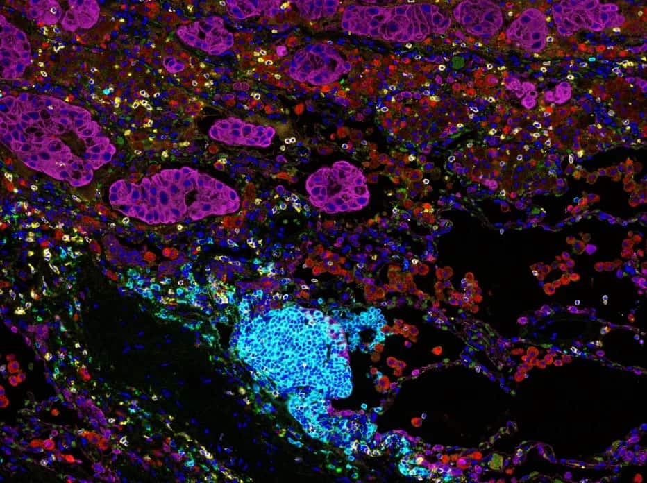 Image mIF de précision